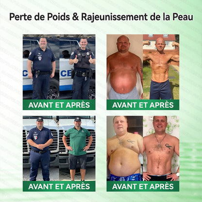 𝑶𝒇𝒇𝒊𝒄𝒊𝒂𝒍 𝑩𝒐𝒖𝒕𝒊𝒒𝒖𝒆✨ | 𝐇𝐞𝐚𝐥𝐫𝐢𝐳𝐞® Patch Microneedle Nanométrique à Extrait de Tissu Adipeux Brun (𝙐𝙣𝙚 𝙛𝙤𝙞𝙨 𝙥𝙖𝙧 𝙟𝙤𝙪𝙧, 𝙘𝙝𝙖𝙣𝙜𝙚𝙢𝙚𝙣𝙩𝙨 𝙫𝙞𝙨𝙞𝙗𝙡𝙚𝙨 𝙚𝙣 7 𝙟𝙤𝙪𝙧𝙨)😮21